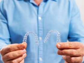 Invisalign Insights