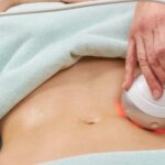 Non-Invasive Body Contouring