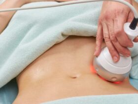 Non-Invasive Body Contouring