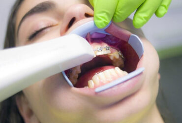 Orthodontic treatments