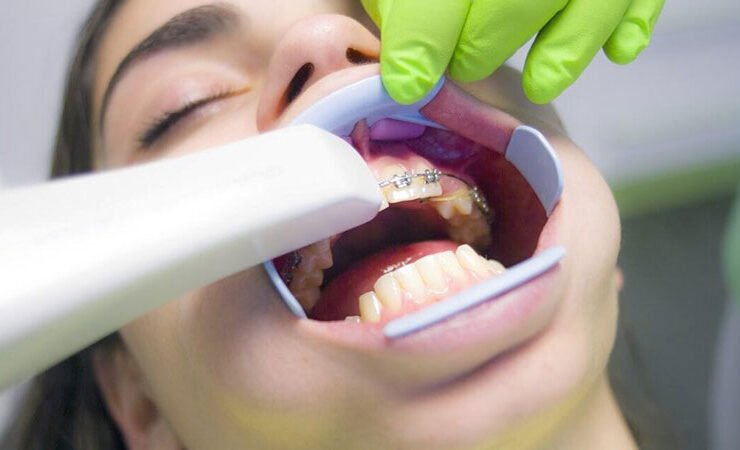 Orthodontic treatments