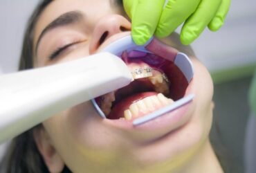 Orthodontics Your Way