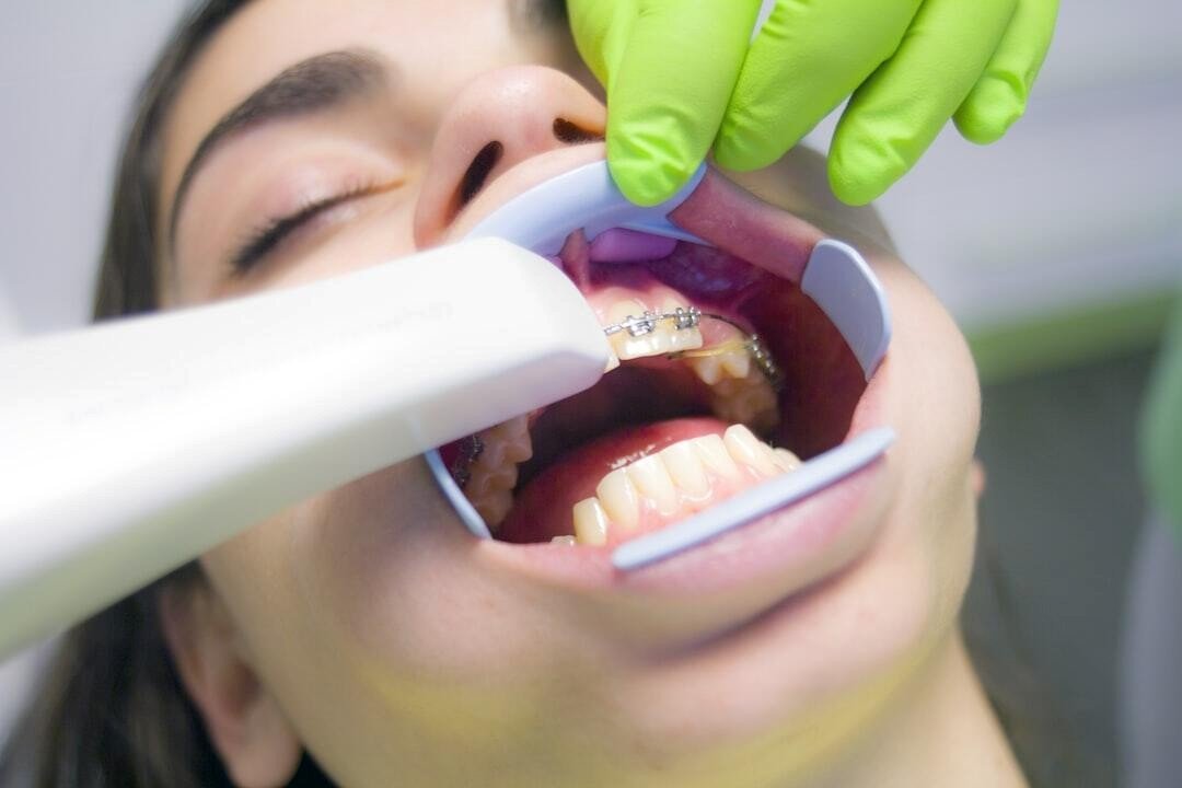 Orthodontics Your Way