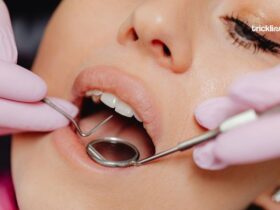 Woman getting Dental check up