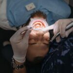 Tooth Cavity Treatment