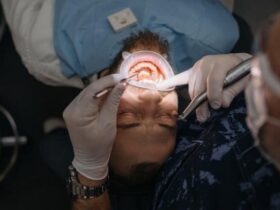 Tooth Cavity Treatment