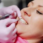 Woman smiling with perfect teeth after dental veneers